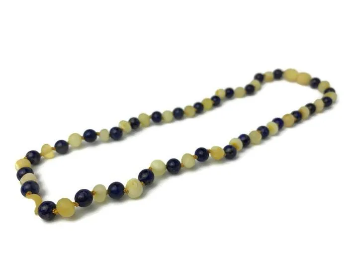 ADHD Anxiety Arthritis Carpal Tunnel Raw Milk Amber Lapis 17 19 MB Earrings