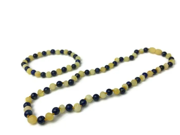 ADHD Anxiety Arthritis Carpal Tunnel Raw Milk Amber Lapis 17 19 MB Earrings