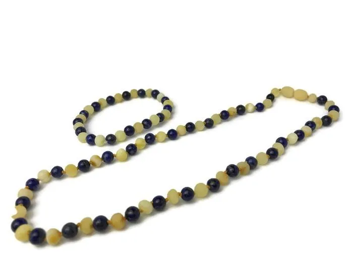 ADHD Anxiety Arthritis Carpal Tunnel Raw Milk Amber Lapis 17 19 MB Earrings